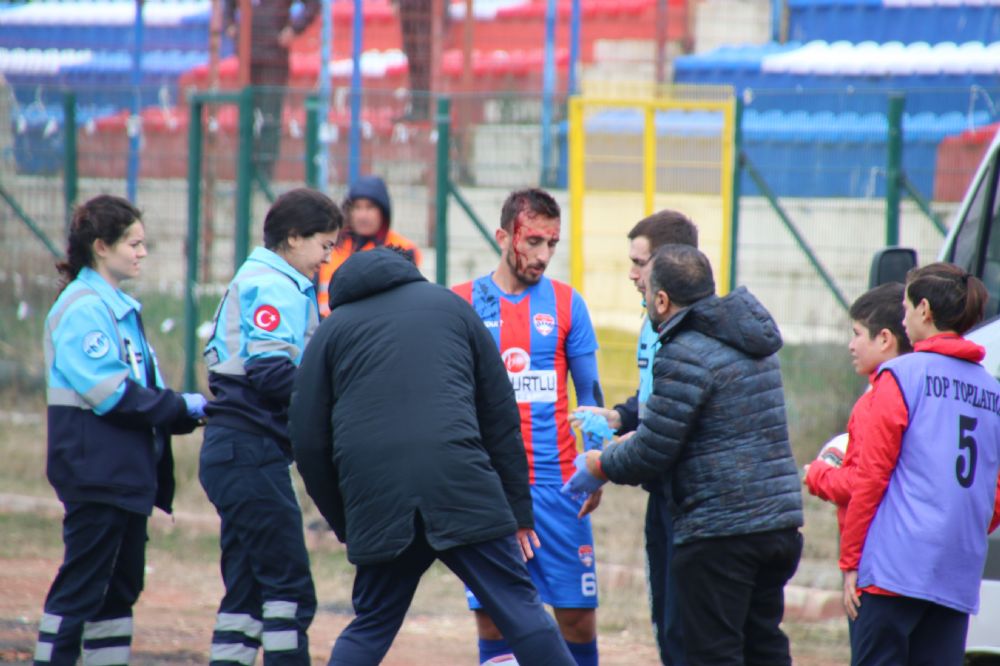 Ambülans ile sahayı terk etti